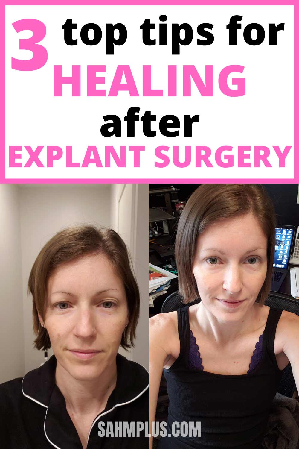 3 recovery tips after explant surgery. Natural healing after surgery